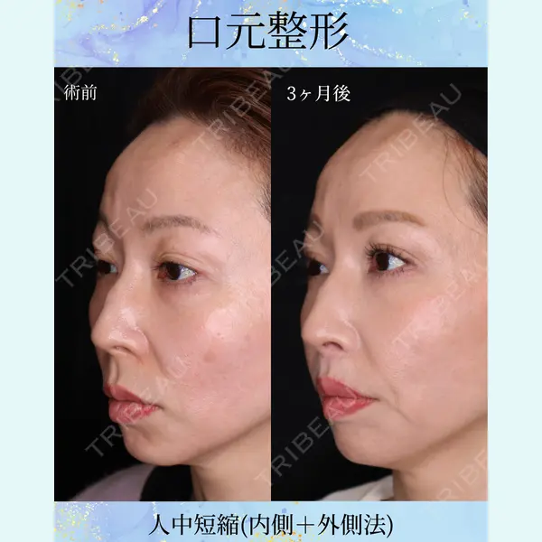 千葉美容外科アイビークリニック 藤田 愛樹医師の症例