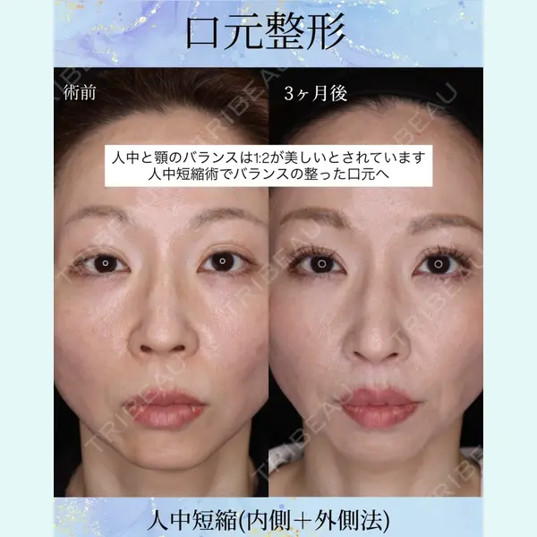 千葉美容外科アイビークリニックの症例