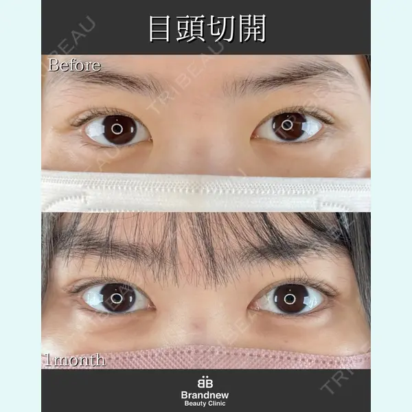 Brandnew Beauty Clinic 平山 容成医師の症例