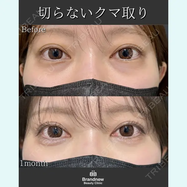 Brandnew Beauty Clinic 平山 容成医師の症例