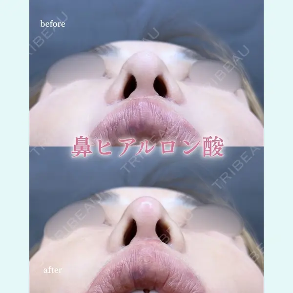 ルラ美容クリニック 町田院 松岡 舟作医師の症例