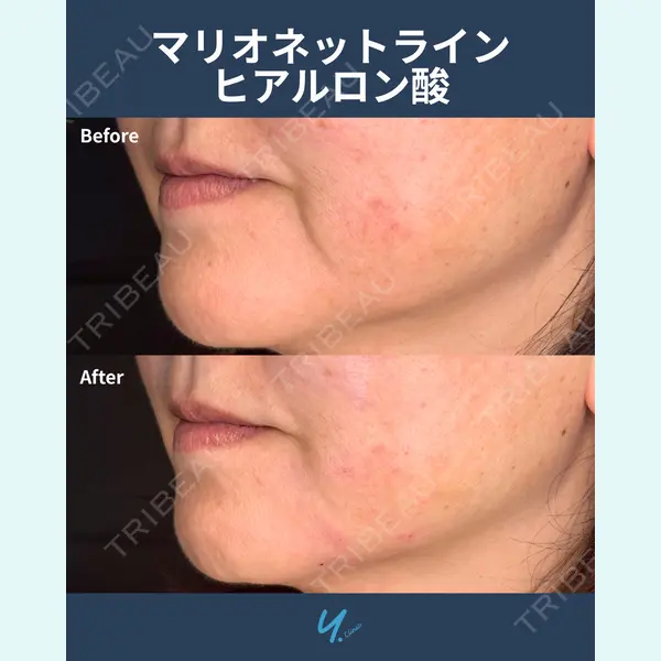 Y.CLINIC 金子　和代医師の症例