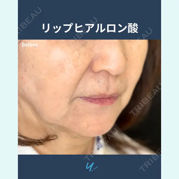 Y.CLINIC 金子　和代医師の症例