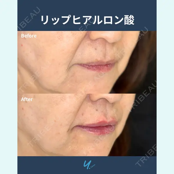 Y.CLINIC 金子　和代医師の症例