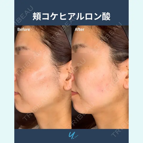 Y.CLINIC 金子　和代医師の症例