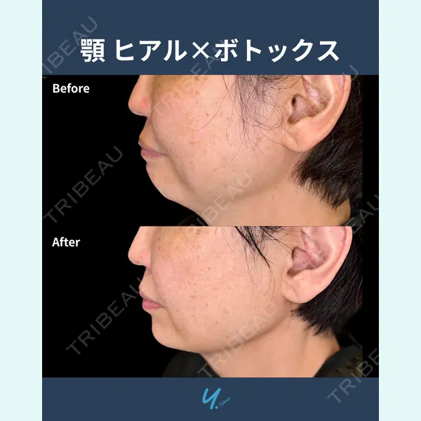 Y.CLINICの症例