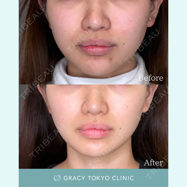 GRACY TOKYO CLINIC【グレイシートウキョウクリニック】 大西 真代医師の症例