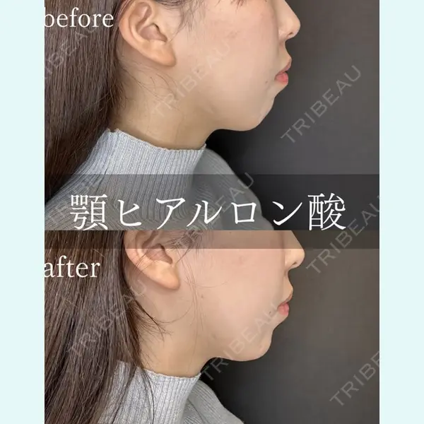 ルラ美容クリニック 大阪心斎橋院の症例