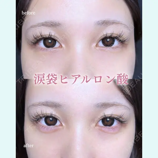 ルラ美容クリニック 町田院 松岡 舟作医師の症例
