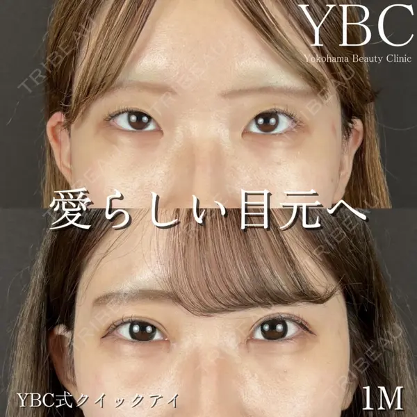 YBC横浜美容外科 立川院 大島 諒士医師の症例