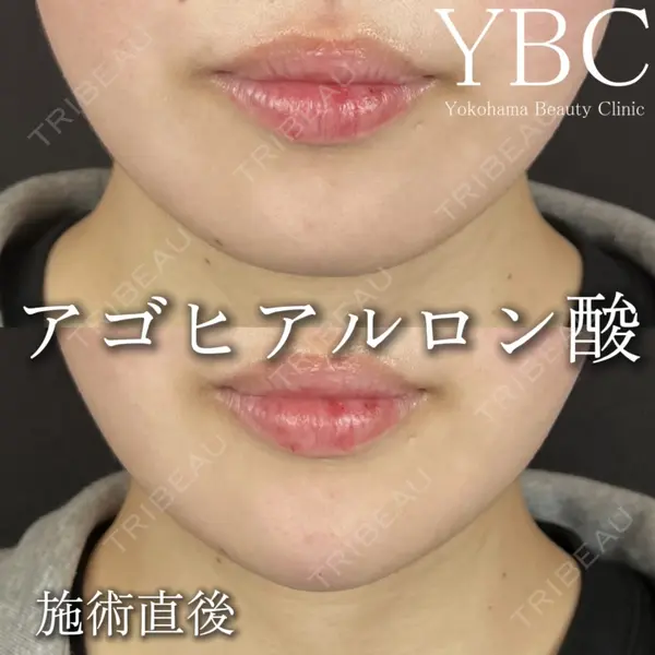 YBC横浜美容外科 立川院 大島 諒士医師の症例
