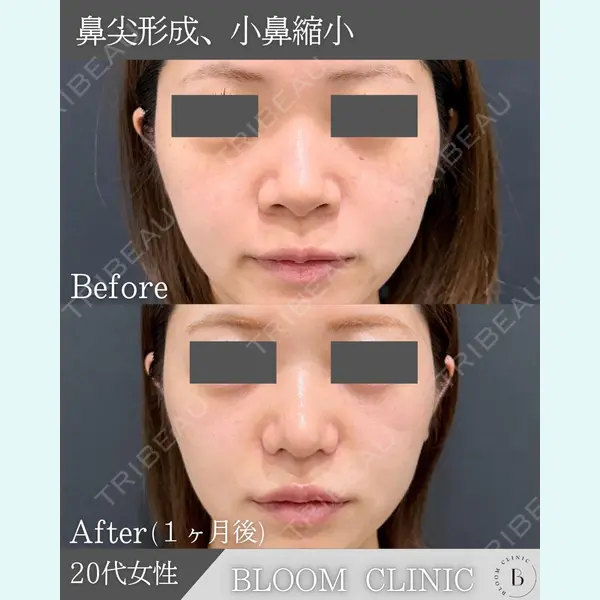 ブルームクリニック（BLOOM CLINIC）の症例