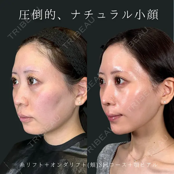 Wing clinic 豊中駅前院 速水 翼医師の症例