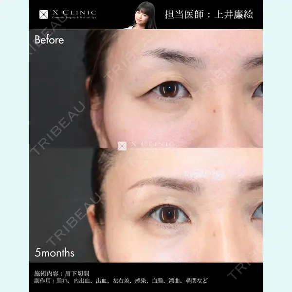 X CLINIC 恵比寿院 上井 廉絵医師の症例