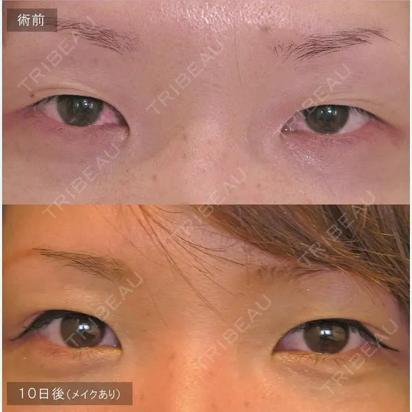 アーティスクリニック 西宮 濱田 英之輔医師の症例