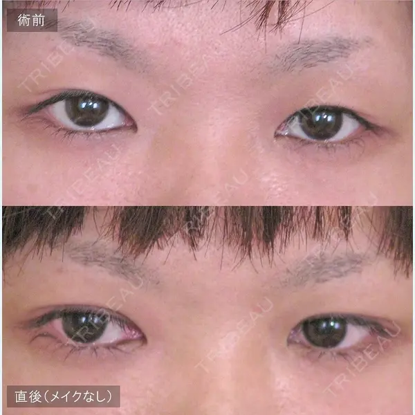 アーティスクリニック 西宮 濱田 英之輔医師の症例