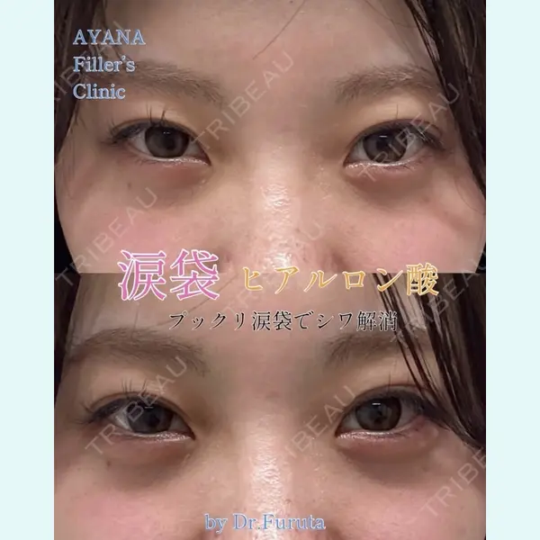 AYANAフィラーズクリニック 渋谷院 古田 晃医師の症例