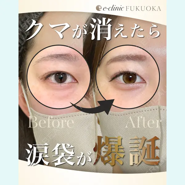 eクリニック 福岡院 伊藤 渉医師の症例