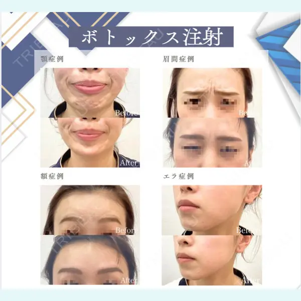 美容皮膚科 デュークリニックの症例