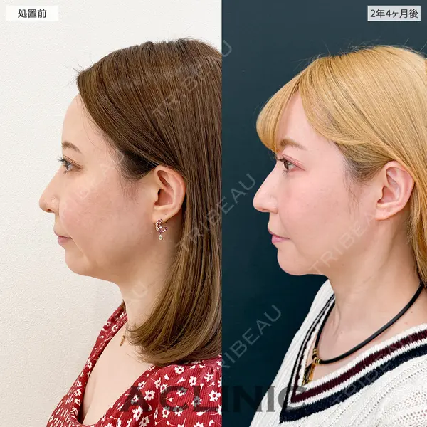 A CLINIC（エークリニック） 新宿院 瀬戸　翔太医師の症例