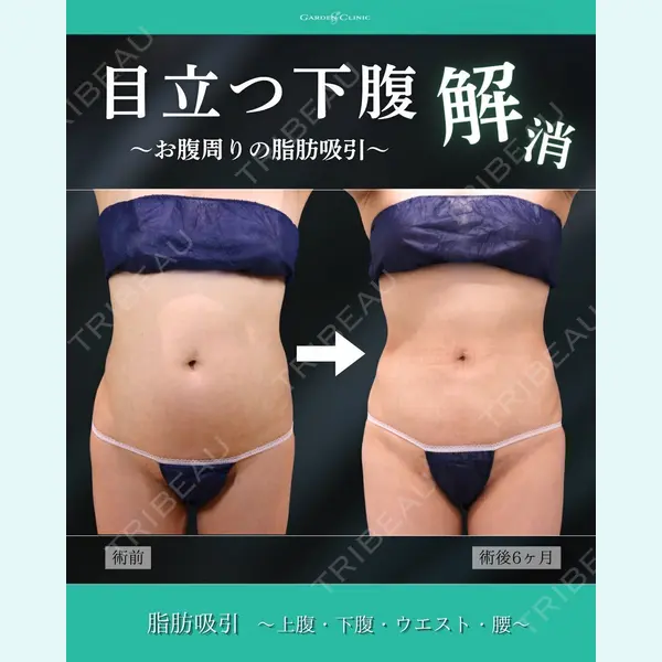 ガーデンクリニック 福岡院 安立 弘太医師の症例