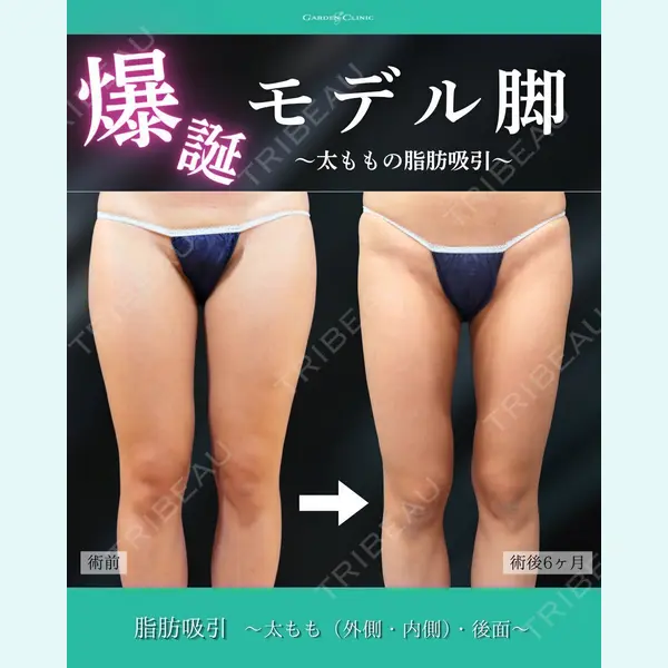 ガーデンクリニック 福岡院 安立 弘太医師の症例