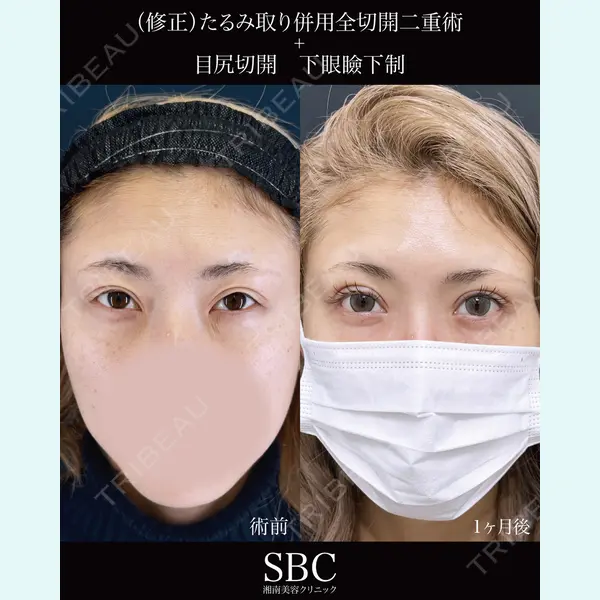 湘南美容クリニック 神戸三宮院 中川 卓医師の症例