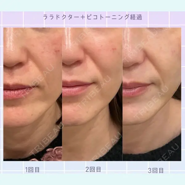 ケセラクリニック 臼居　シホ医師の症例