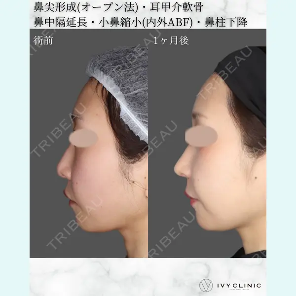 千葉美容外科アイビークリニックの症例