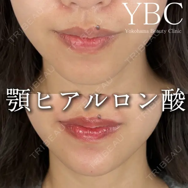 YBC横浜美容外科 立川院 大島 諒士医師の症例