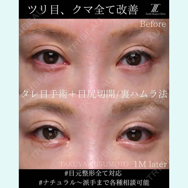 Zetith Beauty Clinic 大阪心斎橋院 楠本 拓哉医師の症例