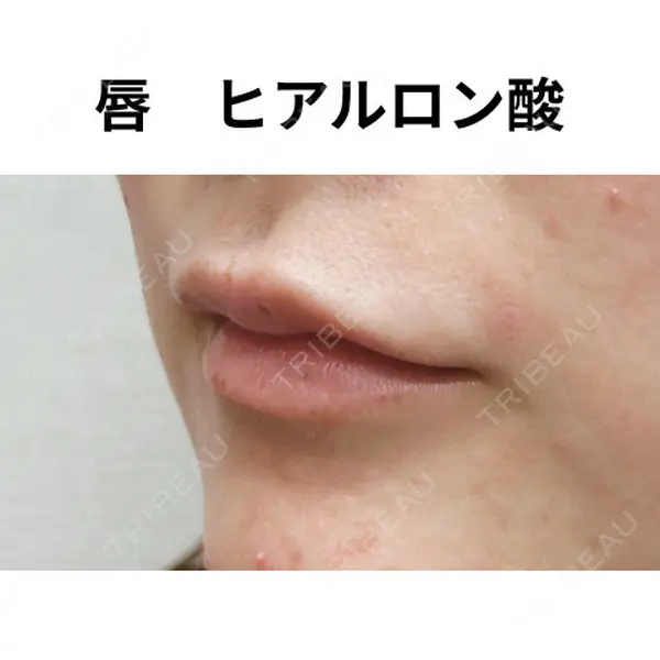 おおたかの森ビューティークリニック 海野 芙美香医師の症例
