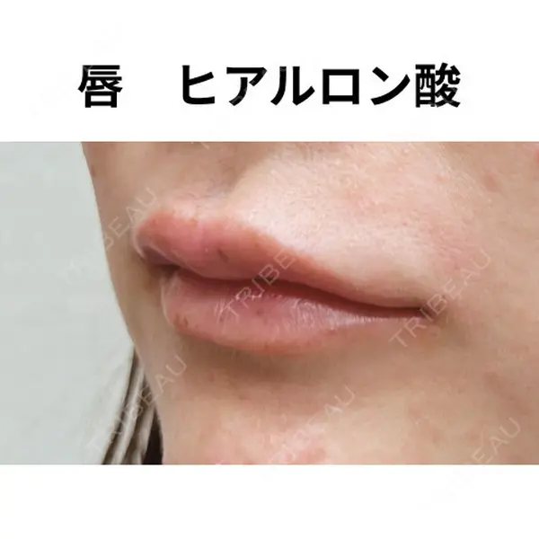 おおたかの森ビューティークリニック 海野 芙美香医師の症例