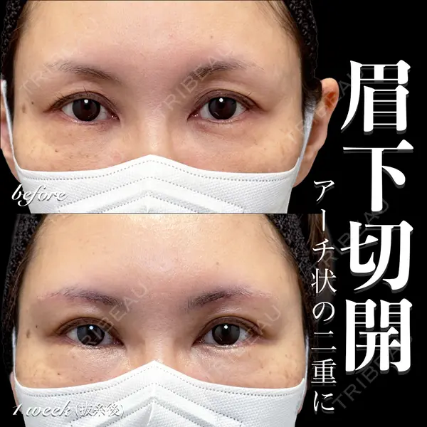 EMMO FACE CLINIC 大宮院 百瀬 直也医師の症例