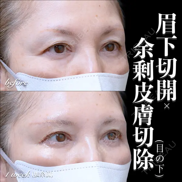 EMMO FACE CLINIC 大宮院 百瀬 直也医師の症例