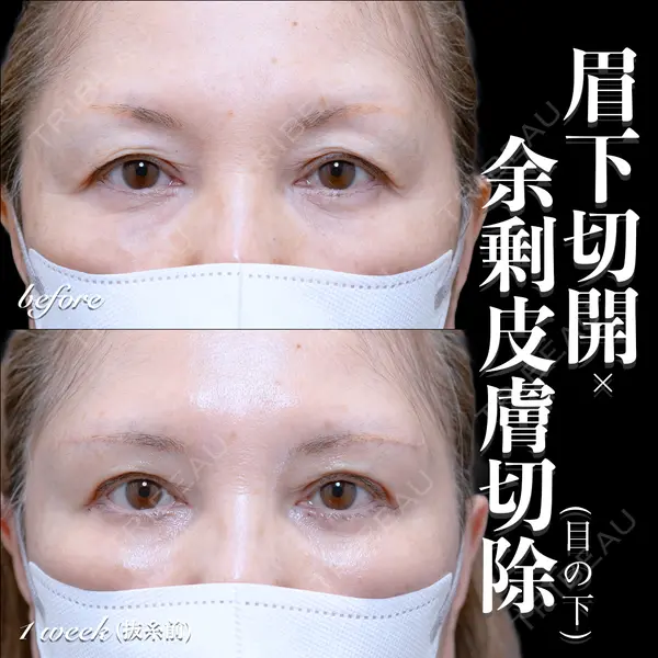 EMMO FACE CLINIC 大宮院 百瀬 直也医師の症例
