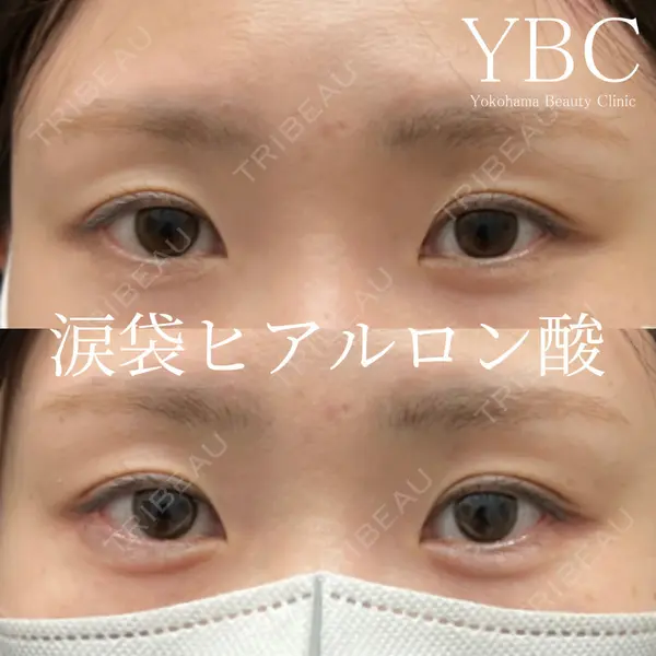 YBC横浜美容外科 池袋院 磯村 亮輔医師の症例