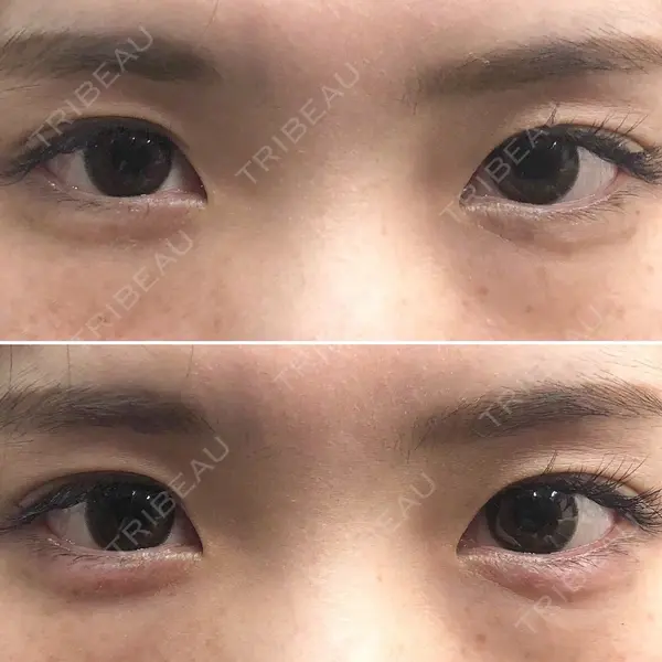 しのぶ皮膚科 蘇原しのぶ医師の症例