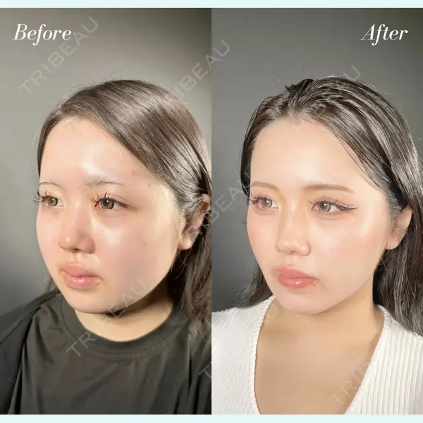 R Beauty CLINIC 名古屋院 木村 尚大医師の症例