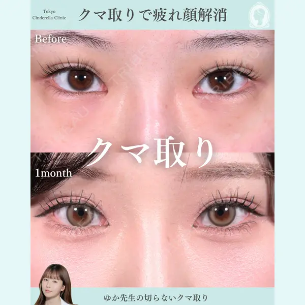 東京シンデレラ美容外科 新宿院 宮﨑友伽医師の症例