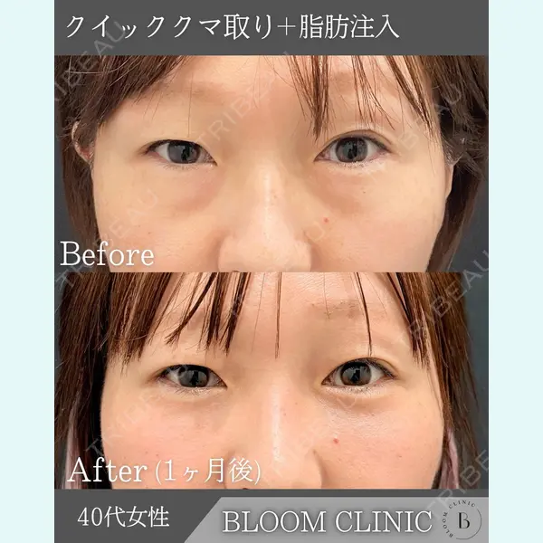 ブルームクリニック（BLOOM CLINIC）の症例