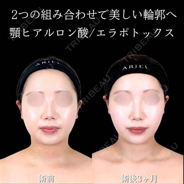 アリエル美容クリニック 横浜院 渡邉 光医師の症例