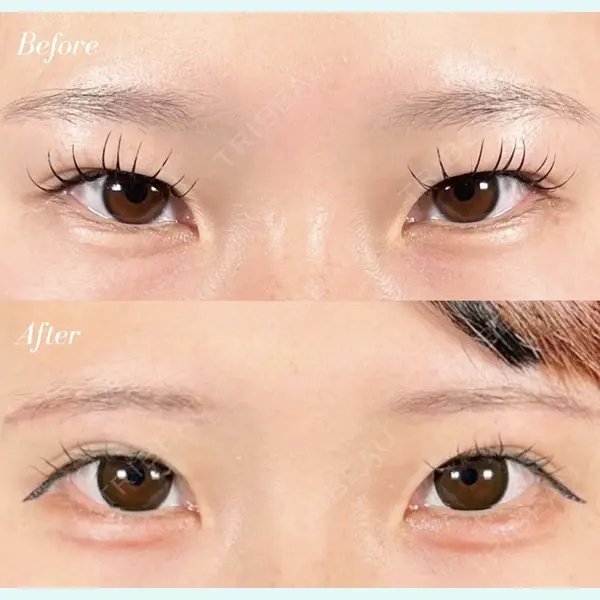 R Beauty CLINIC 名古屋院 木村 尚大医師の症例