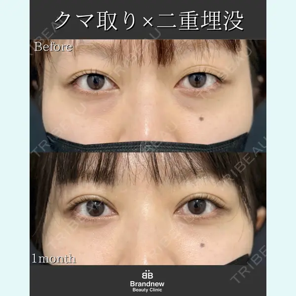 Brandnew Beauty Clinic 平山 容成医師の症例