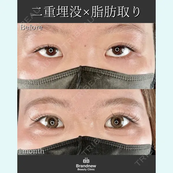 Brandnew Beauty Clinic 平山 容成医師の症例