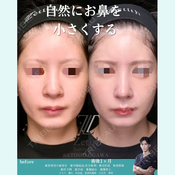 Zetith Beauty Clinic 銀座院 小川 悟史医師の症例