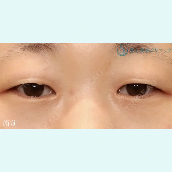 聖心美容クリニック 六本木院 菱田 健作医師の症例