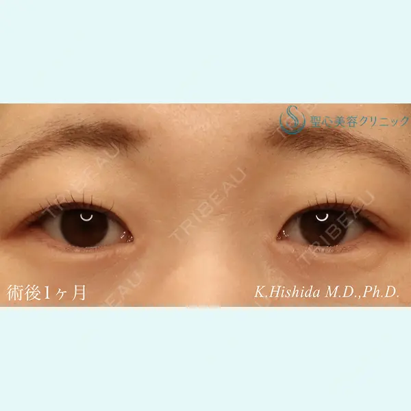 聖心美容クリニック 六本木院 菱田 健作医師の症例