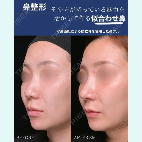 Zetith Beauty Clinic 銀座院 守屋 亜妃医師の症例