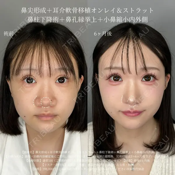 ASTRA BEAUTY CLINIC 塩満 惠子医師の症例